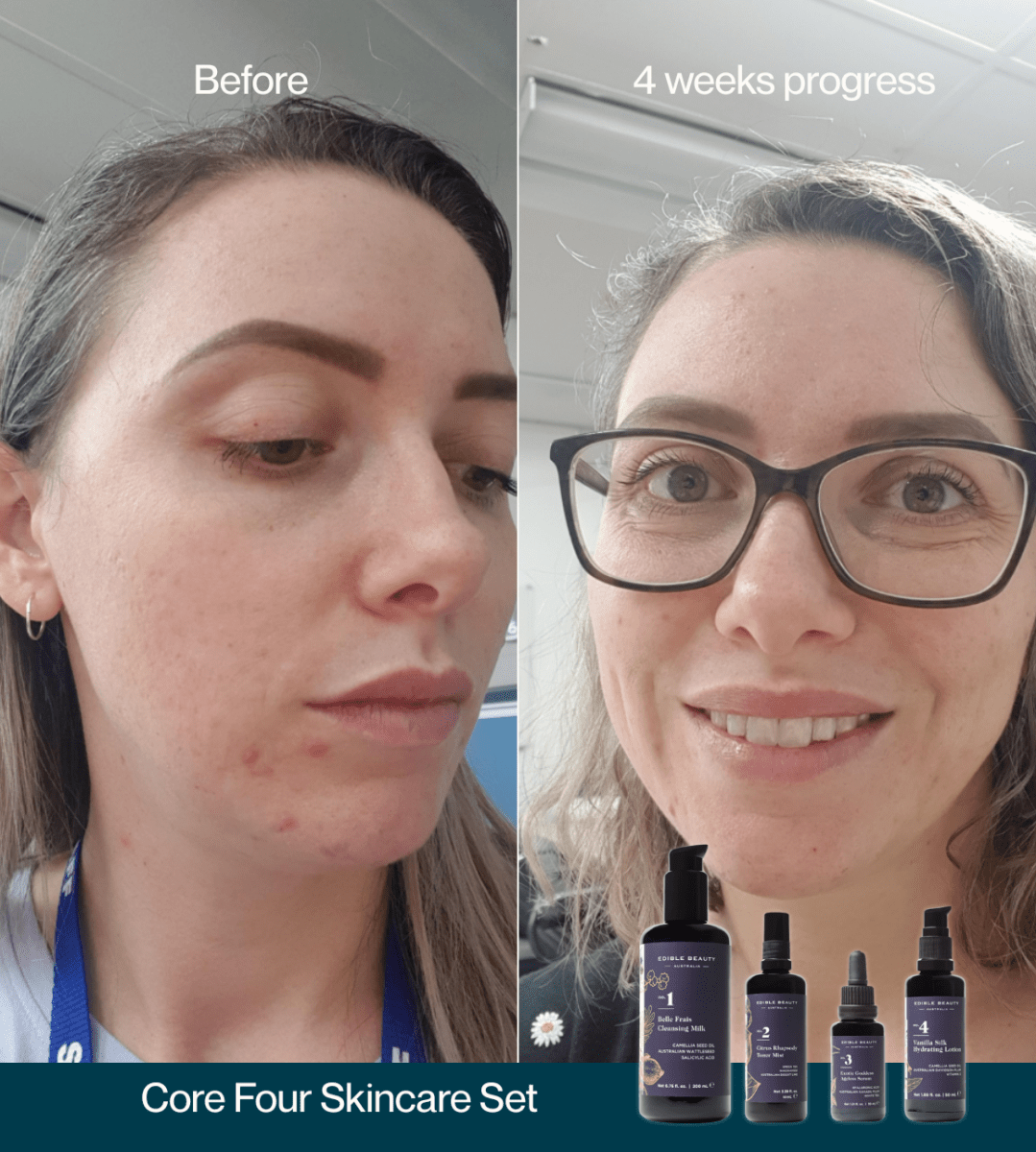 Pure Skincare Discovery Set - Edible Beauty Australia