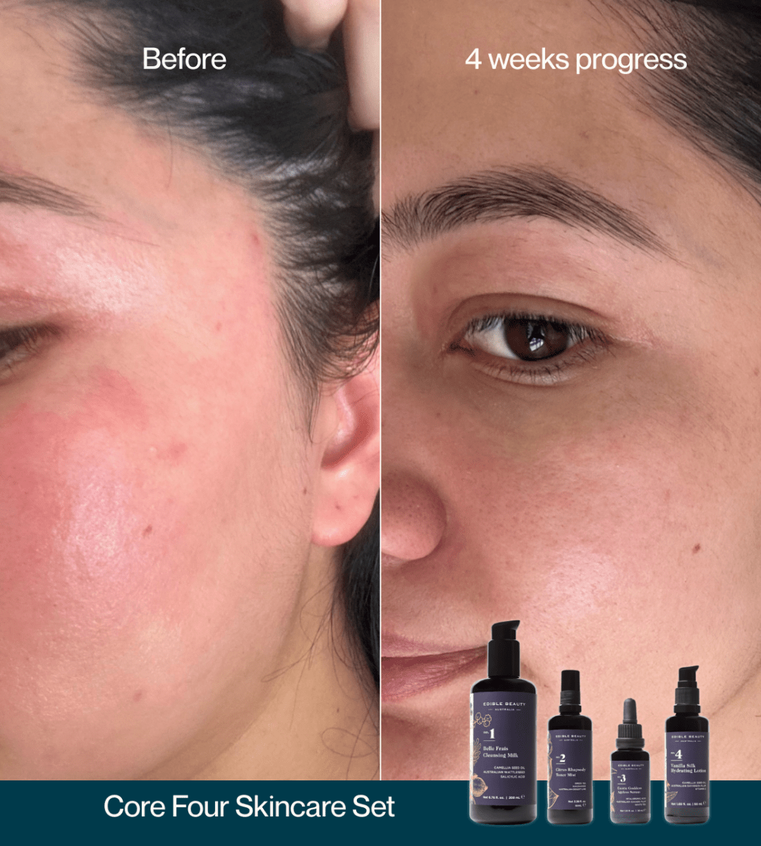Pure Skincare Discovery Set - Edible Beauty Australia